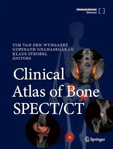 Atlas lâm sàng về SPECT/CT xương