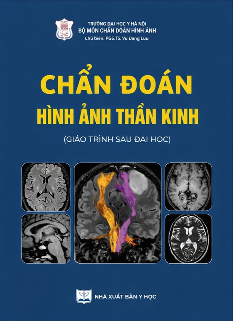 Chẩn đoán hình ảnh thần kinh PDF