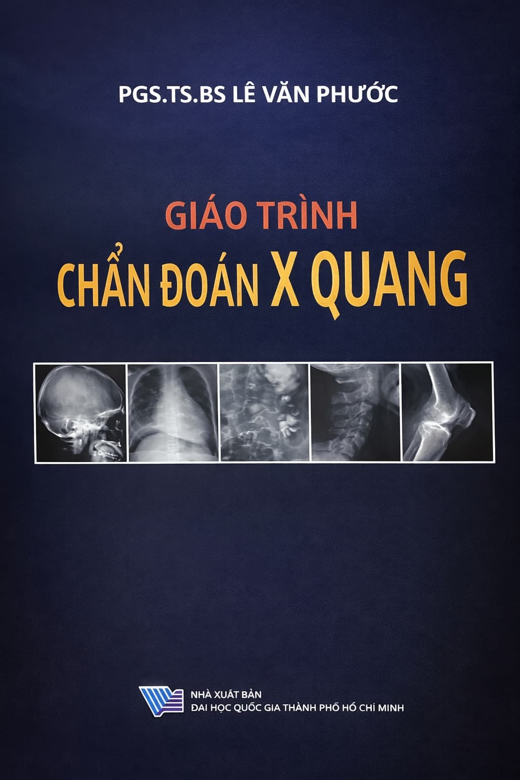 Giáo trình Chẩn đoán X-quang PDF