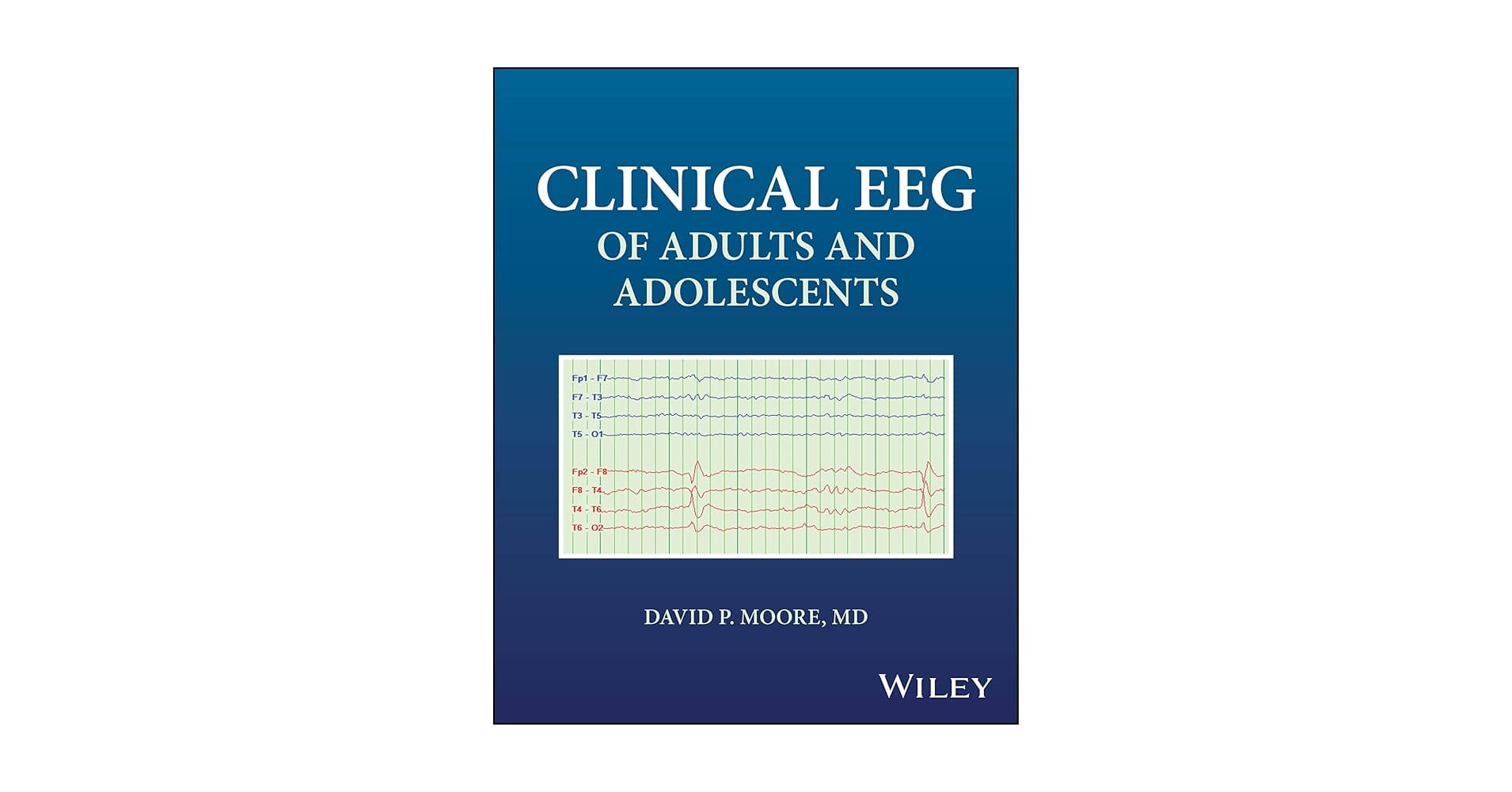 Điện đồ não (EEG) lâm sàng ở người lớn và thanh thiếu niên 2025