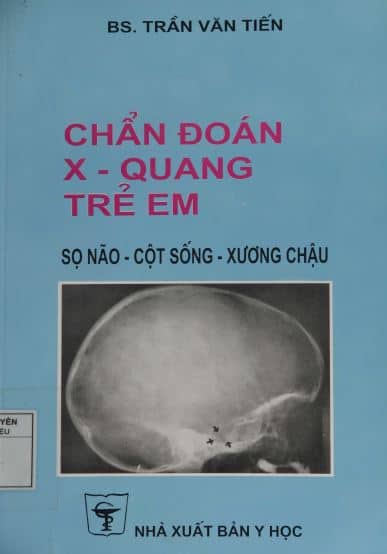 chan-doan-xq-tre-em