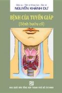 Benh-tuyen-giap-buou-co