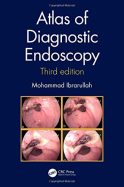 atlas-of-diagnostic-endoscopy-3e_5f3cd3aae6c5f