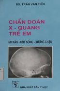 chan-doan-xq-tre-em