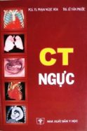 ct-nguc