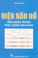 dien-nao-do