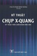 ky-thuat-chup-xquang