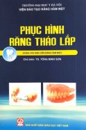 phuc-hinh-rang-thao-lap