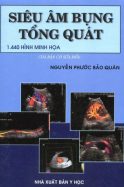 sieu-am-bung-tong-quat