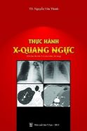 thuc-hanh-xquang-nguc